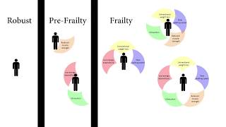 Measuring Frieds Frailty Phenotype [upl. by Gerta541]