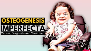 OSTEOGENESIS IMPERFECTA OI Causes Signs and Symptoms Diagnosis and Treatment [upl. by Adlez154]