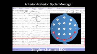 Introduction to EEG [upl. by Purse]