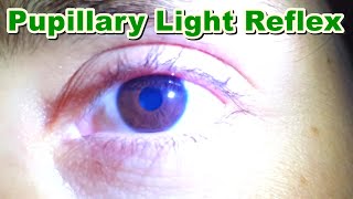 Pupillary Light Reflex  Contraction of Pupil MiosisMyosis  Function  Brain Stem [upl. by Bertelli]