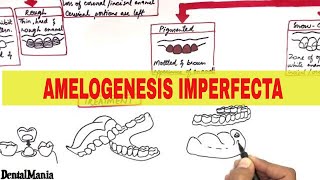 Amelogenesis Imperfecta  Pathogenesis Types Clinical features and Treatment [upl. by Ecirtemed]