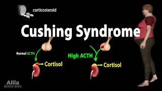 Cushing Syndrome Animation [upl. by Arretal]