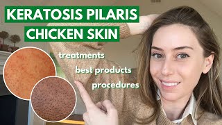 HOW TO GET RID OF STRAWBERRY LEGS IN ONE DAY Get Rid Of Keratosis Pilaris And Dark Spots On Legs [upl. by Nitsej671]